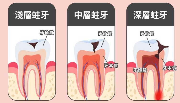 深圳杜牙根