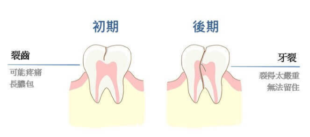 深圳杜牙根價格