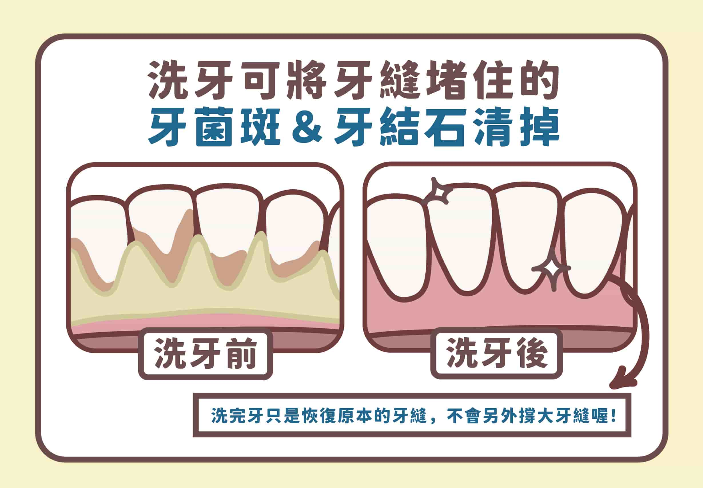 深圳洗牙价格