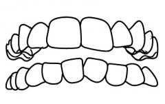 什麼牙齒情況適合隱形矯正？